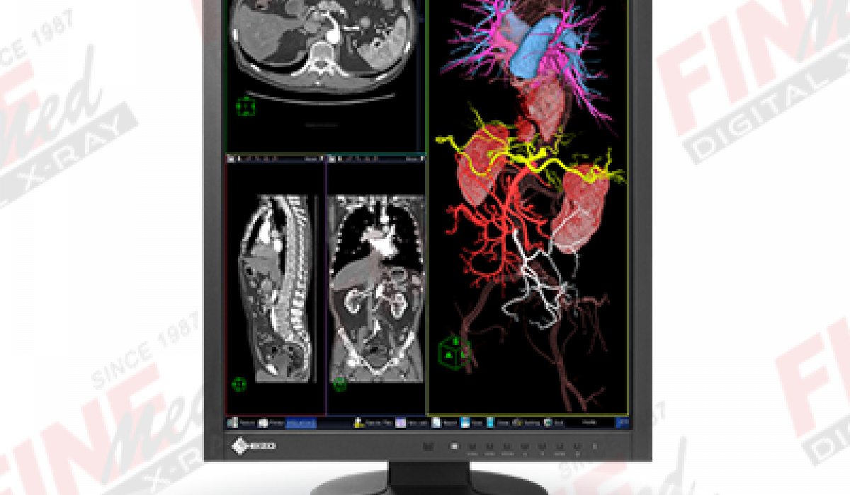 EIZO RadiForce MX215